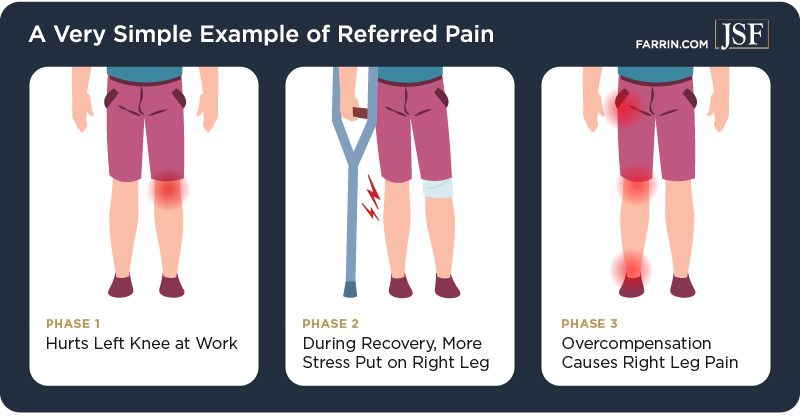 Overcompensating for an initial injury can lead to pain in other parts of the body, called "referred pain."
