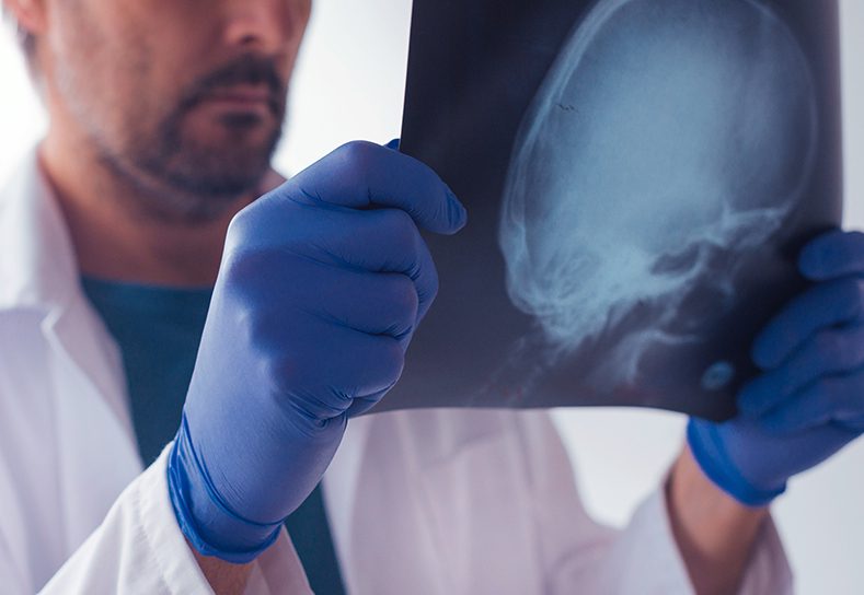 Doctor examining a radiograph of a skull.