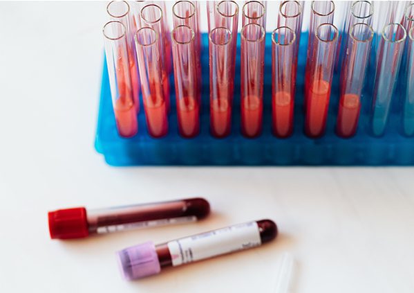 Two vials of drawn blood on a lab desk next to a set of glass test tubes.