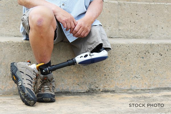 Law Offices of James Scott Farrin North Carolina workers’ compensation attorneys. Worker with prosthetic leg sits on steps after serious workplace injury.